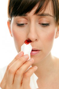 Die meisten Blutungen treten im vorderen Teil der Nase auf